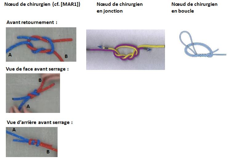 image Noeud de chirurgien