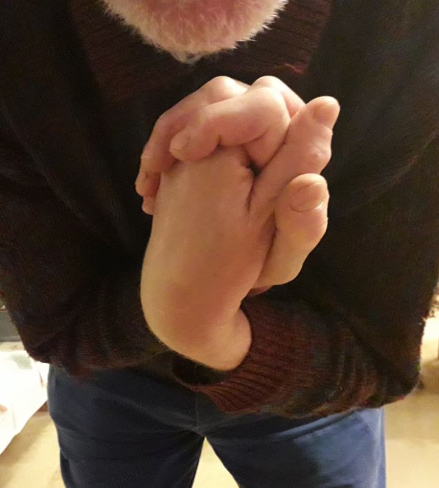 picture Hands turned over